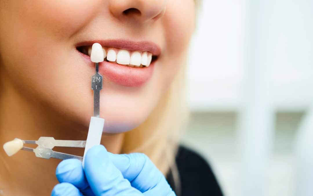 Which Cosmetic Dentistry Treatment is Right for You?