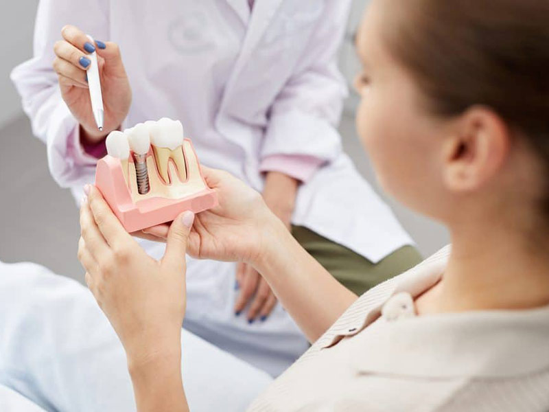 What Are the Three Stages of Dental Implants? featured image