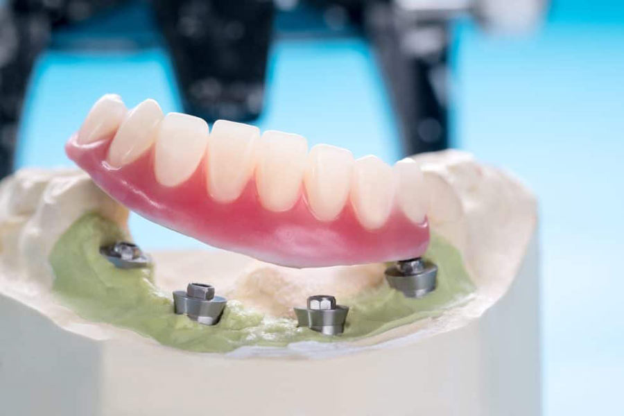 Teeth Model