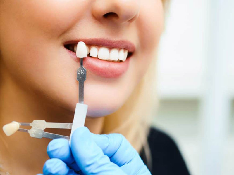 Which Cosmetic Dentistry Treatment Is Right for You? featured image